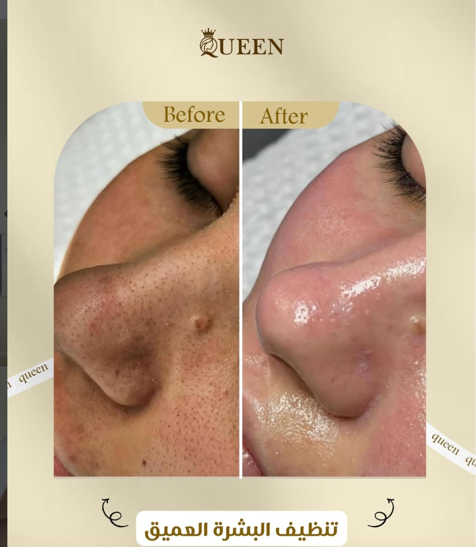 افضل جلسات تنظيف البشرة