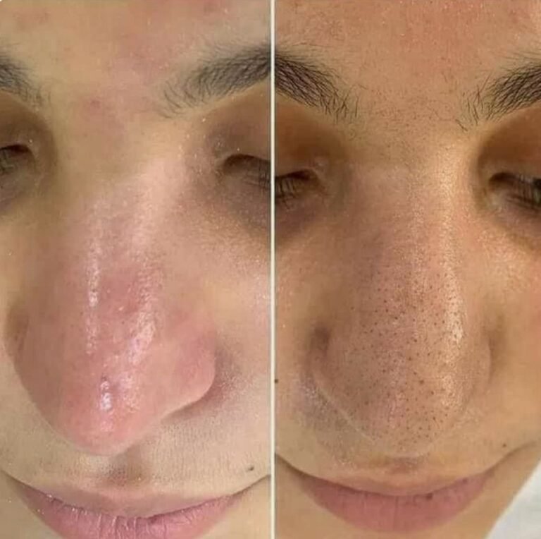 أفضل عيادة جلدية وتجميل في الرياض