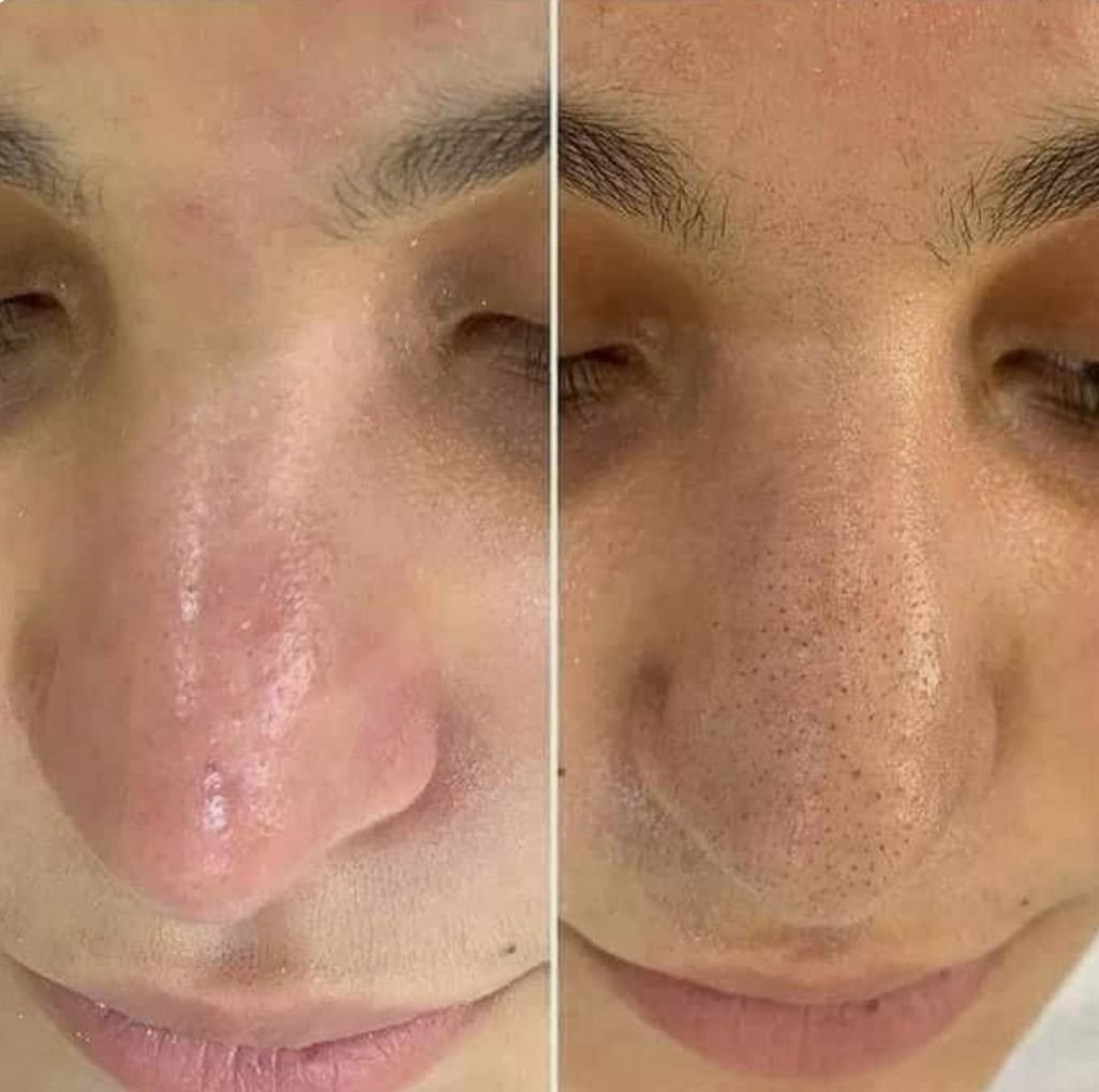 أفضل عيادة جلدية وتجميل في الرياض