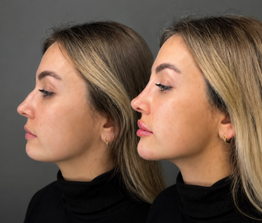 أفضل عمليات التجميل في السويدي الرياض