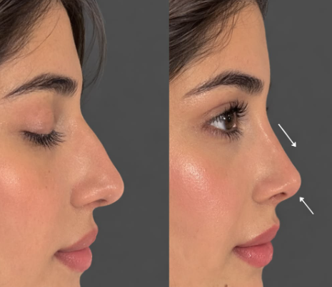 أسعار جراحة التجميل بالرياض