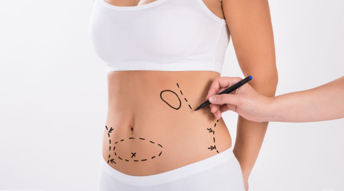 أسعار عمليات التجميل في الرياض