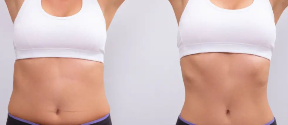 تعليمات قبل جراحة التجميل