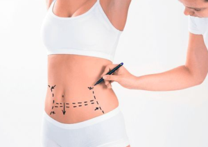 الاستعداد لعملية التجميل