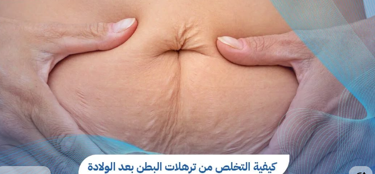 مامي ميك أوفر بعد الولادة