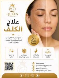 علاج الكلف