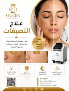 علاج التصبغات