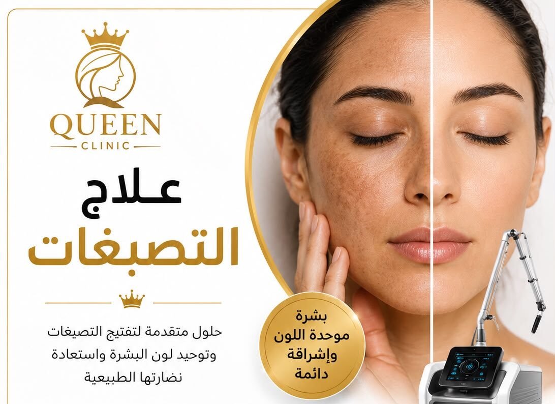 أفضل علاج لتصبغات الوجه في السويدي - الرياض