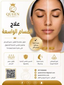 علاج المسام الواسعة