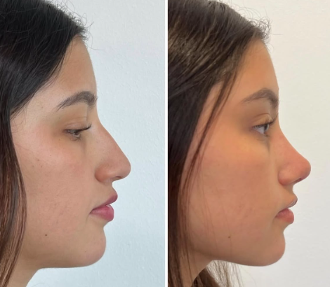 التجميل الجراحي في السويدي الرياض