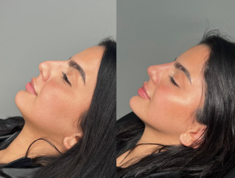 عمليات التجميل في الرياض